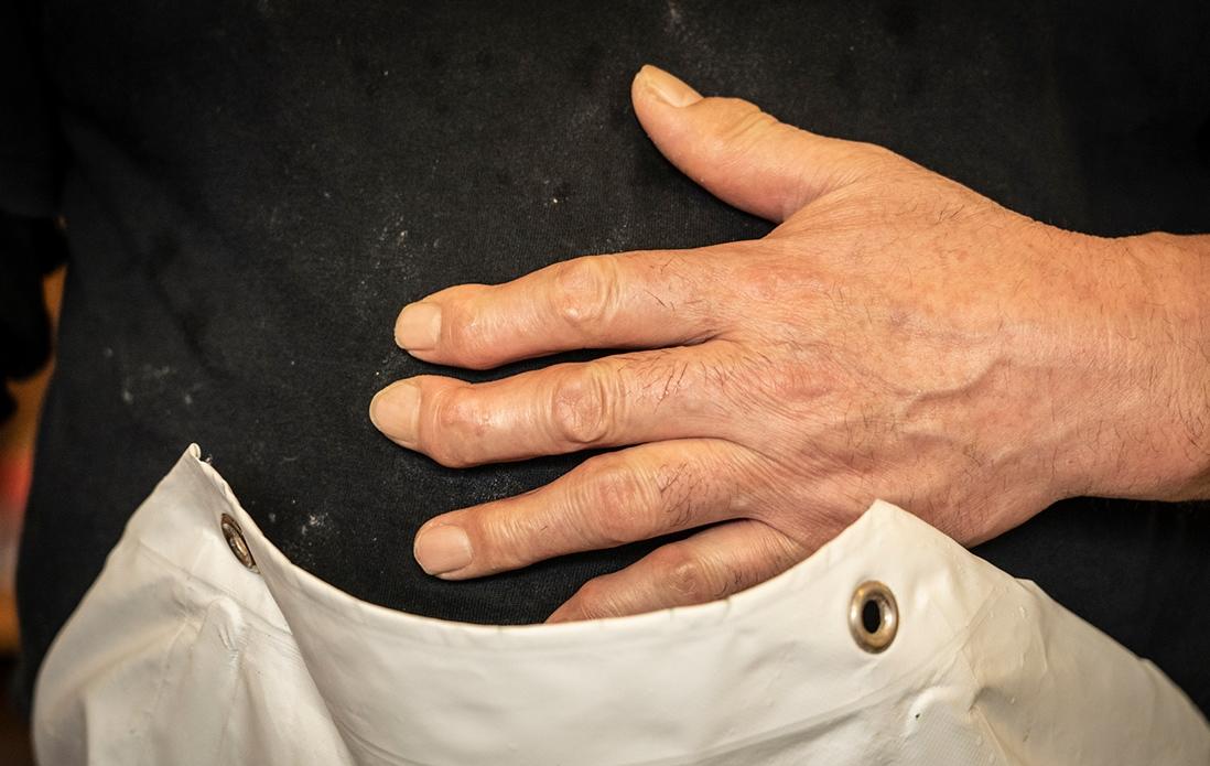 人並外れたパワーで長年大量の麺を打ち続け、変形してしまった井島さんの指。